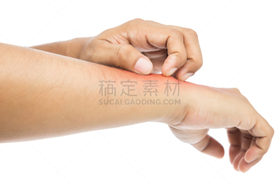 垃圾,身体受伤,替代疗法,辅导讲座,四肢,水平画幅,努力,仅男人,仅成年人,皮炎