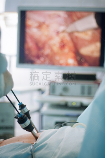 胆囊,搬家卡车,垂直画幅,腹腔镜手术,手术帽,肿瘤学,实验室,技术,急救员,成年的