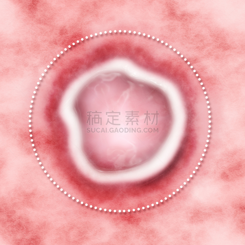人的嘴,溃疡,水泡性口炎,状态,有毒物质,良性的,鹭管鱼,嘴唇,身体受伤
