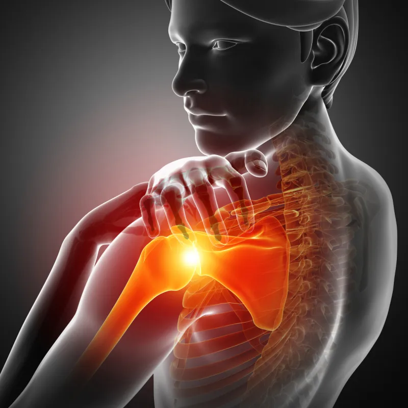 痛苦 关节 手臂 女人 断胳膊 肘 人类肌肉 生物医学插图 身体受伤 替代疗法图片素材下载 稿定素材