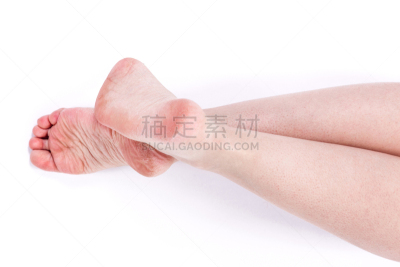 足,皮肤,干旱,皮炎,皮肤病学,四肢,平视角,腿,干的,男性
