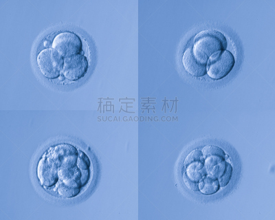 人体细胞,卵,人类兹戈特,人工授精,干细胞,显微图片,孕检,染色体,显微镜,人造的