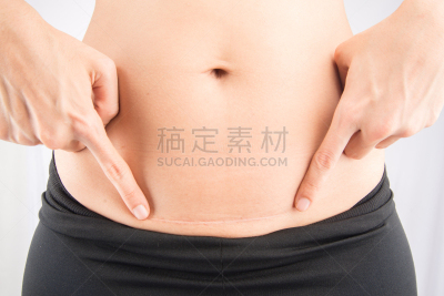 母亲,女人,肥胖,肚子,水平画幅,形状,腹腔,特写,妊娠纹
