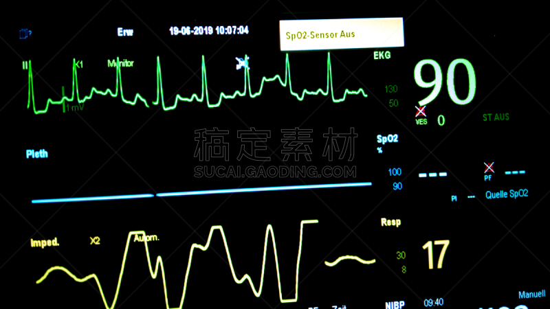 血压计,脉搏图,不规则的,心电图,心血管系统,血流动,人类心脏,心肌层,急救员