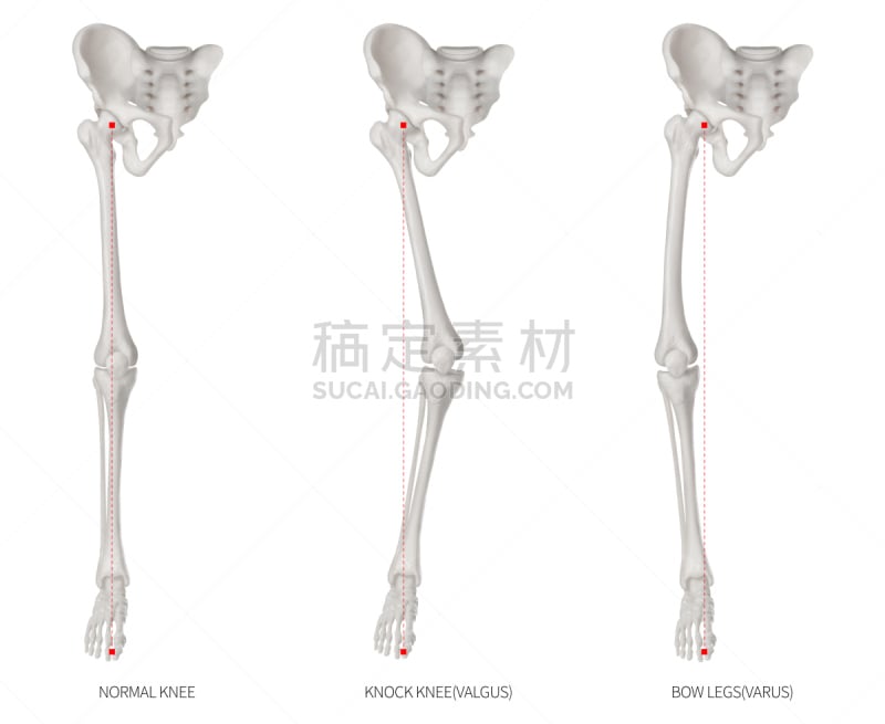 膝,四肢,健康保健,腿骨,概念,插画,白色背景,教育,生病