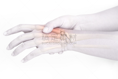 身体受伤,腕骨,人类骨架,水平画幅,重复性运动损伤,情绪压力,努力,锐角,偏远的,腕管症