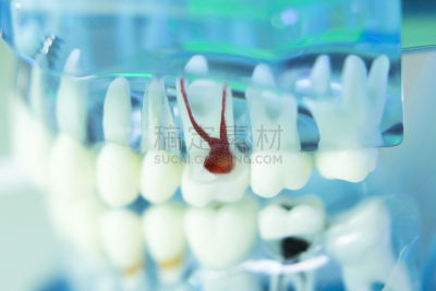 牙医,人的嘴,口腔卫生,人的牙齿,模型,人造的,假牙,水平画幅,使用嘴巴,干净
