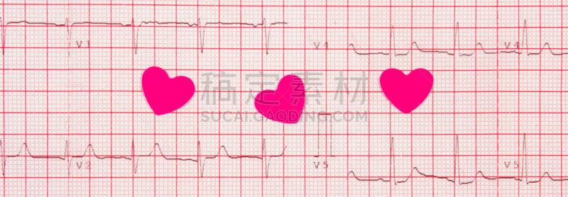 健康保健,图表,纸,心电图,概念,人类心脏,方格纸,脉诊,水平画幅,形状