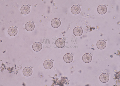 原生动物,大肠杆菌,内阿米巴属,吧椅,显微镜,水,生物发光,水平画幅,酵母,微生物学