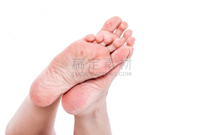 足,皮肤,干旱,皮炎,皮肤病学,四肢,平视角,腿,干的,男性