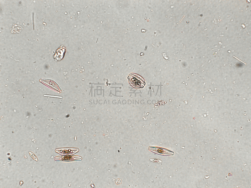 硅藻属,放大效果,在下面,生物学,生物燃料,显微镜,退化单眼,淡水,海洋生命,环境