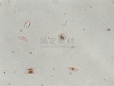 硅藻属,放大效果,在下面,生物学,生物燃料,显微镜,退化单眼,淡水,海洋生命,环境