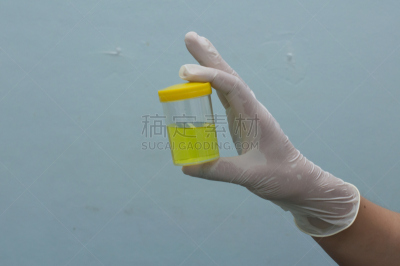 特写,尿检样品,健康保健,水平画幅,科学实验,标签,实验室,肾,容器