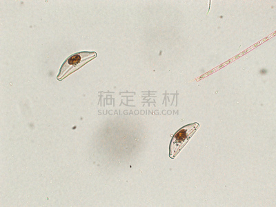 硅藻属,藻类,放大效果,在下面,生物学,生物燃料,显微镜,退化单眼,淡水,海洋生命