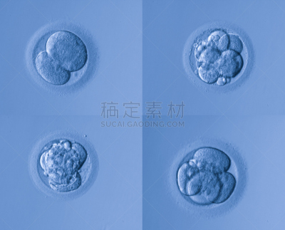 人类兹戈特,显微图片,染色体,生物科技,水平画幅,微生物学,无人,胚胎,科学实验,科学