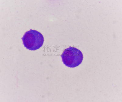 癌症,代表,黑色素瘤,皮肤病学,显微镜,水平画幅,医疗保险,蓝色