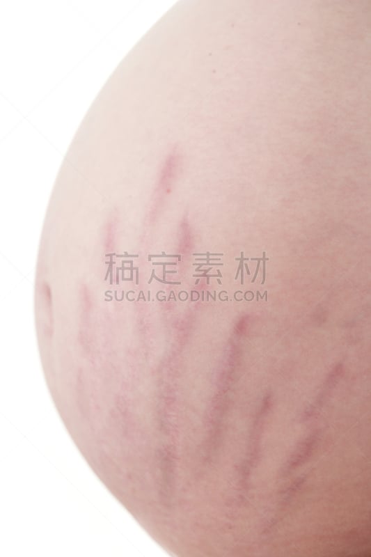 肚子,妊娠纹,垂直画幅,美,父母,巨大的,腹腔,新生活,母亲,成年的