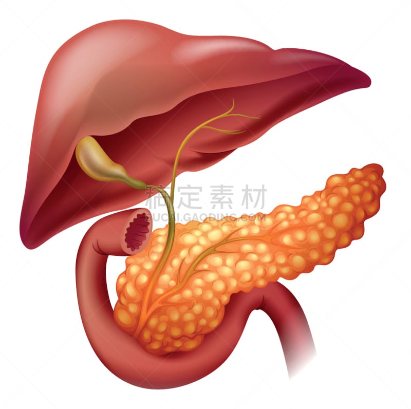 图表,癌症,胰腺,大特写,生物学,症状,有序,健康保健,生物医学插图