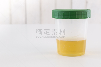 尿检样品,健康保健,特写,水平画幅,无人,塑胶,实验室,容器,杯,尿液