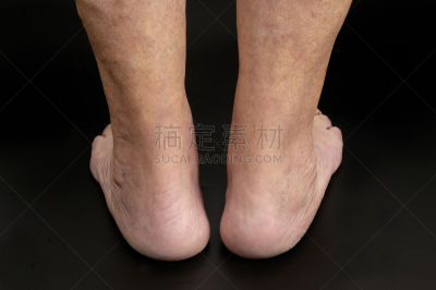 跟腱,状态,古老的,老年女人,图像,女人,成年的,中老年人,足