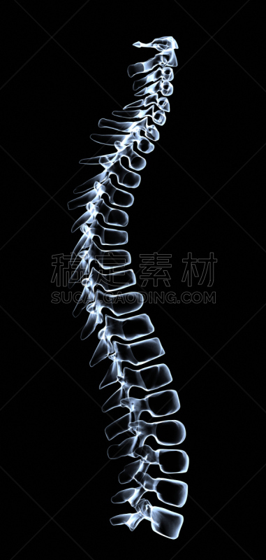 整形器具,垂直画幅,形状,无人,全景,x光片,结论,健康保健,黑色