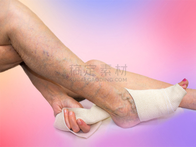 老年女人,腿,弹性绷带,平衡折角灯,静脉曲张,维管束,心血管系统,调整,捆扎,浮肿