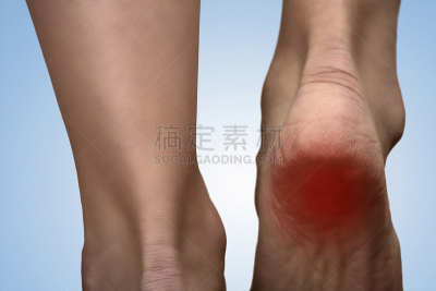 马剌,痛苦,关节炎,女人,足,羊毛帽,鞋底,概念,氮,阿基里斯