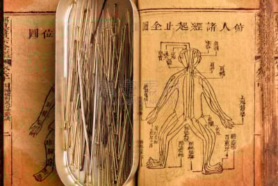 针灸针,易经,针灸,中医,汉字,中文,图腾柱,以前的,道教,牛皮纸