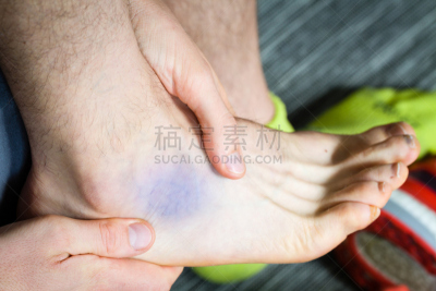 瘀伤,踝,鹭管鱼,通道地毯,足部骨骼,脚掌,身体受伤,替代疗法,辅导讲座,水平画幅