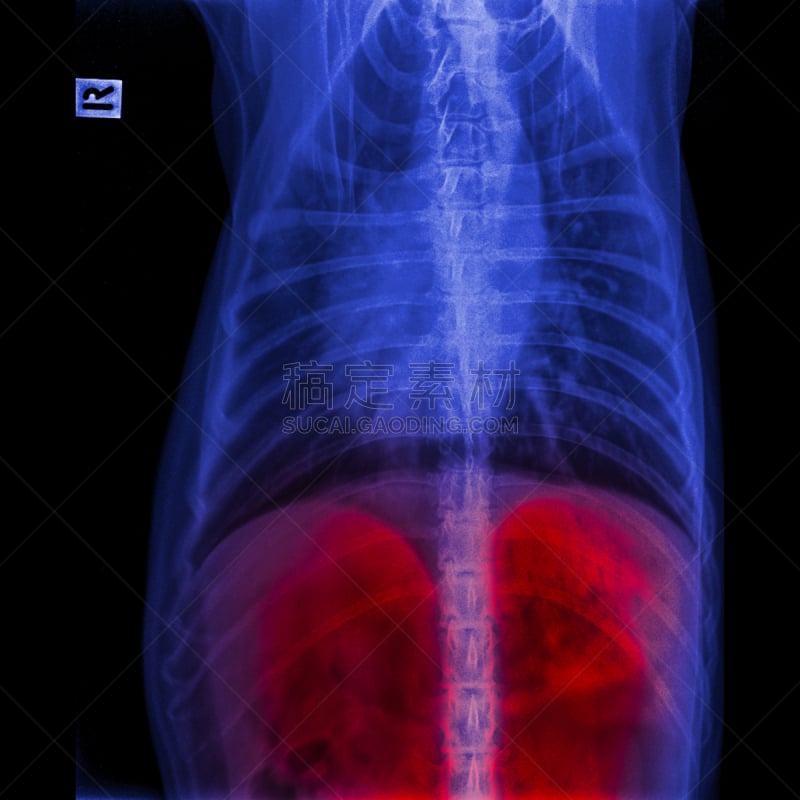 健康保健,狗,肝脏,胸部,胸腔,x光,生理学,兽医,概念