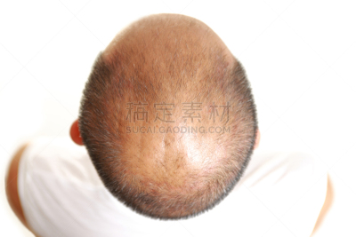 中老年男人,无法辨认的人,仅男人,一个人,损失,仅一个男人,不关心,头发,发型,中老年人