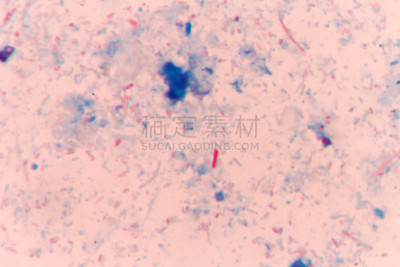 微孢子目,水平画幅,无人,绘画插图,真菌学,科学,计算机制图,计算机图形学,图像,真菌