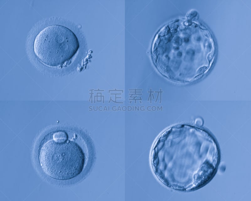 人类兹戈特,胚胎,显微图片,染色体,生物科技,水平画幅,微生物学,无人,科学实验,科学