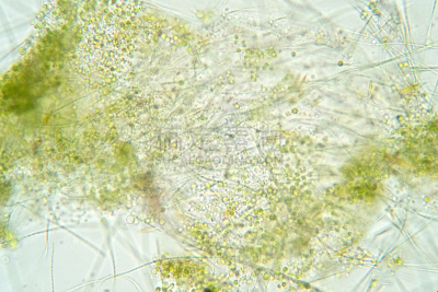 藻类,透明,灯丝,长的,穿入,一个物体,项链,植物细胞,公亩
