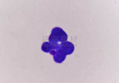 癌症,代表,黑色素瘤,皮肤病学,显微镜,水平画幅,医疗保险,蓝色
