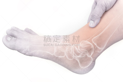 足部骨骼,身体受伤,跎骨,水平画幅,骨骼,健康保健,关节,摄影