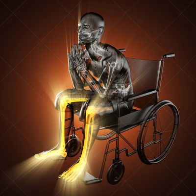 轮椅,男人,身体受伤,车轮,人类骨架,易接近性,椅子,科学,生物学,关节炎