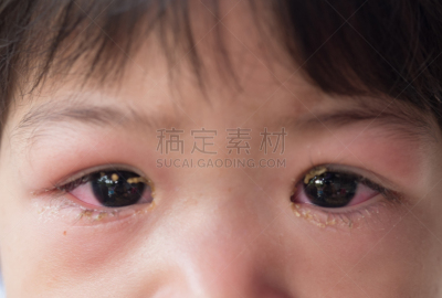 人的眼睛,球,身体受伤,眼睑,水平画幅,科学实验,化妆用品,特写,泰国