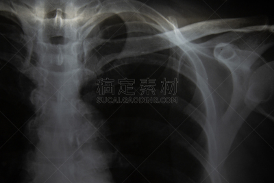 人,x光,成年的,人体,人类肺脏,人体内脏器官,人类心脏,胸部,手,骨骼