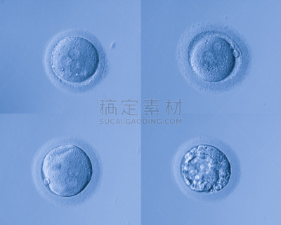人体细胞,卵,人类兹戈特,干细胞,人工授精,孕检,染色体,显微镜,人造的,生物科技