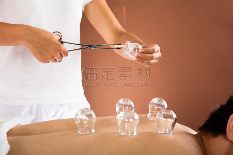 拔罐,男人,水平画幅,spa美容,部分,成年的,火焰,女人,美容院