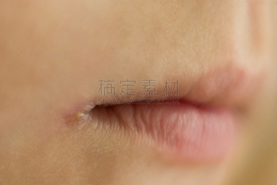 皮肤,人的嘴,水泡性口炎,角落,问题,角度,链球菌,粘液,膜,生病