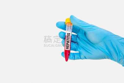 肝炎,试管,医学检测,黄疸病,乙型肝炎病毒,瘟疫,医疗保险,水平画幅,科学,健康保健