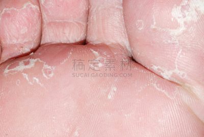 干的,皮肤,纹理效果,大特写,人类脚趾,在下面,水平画幅,化妆用品,特写,部分
