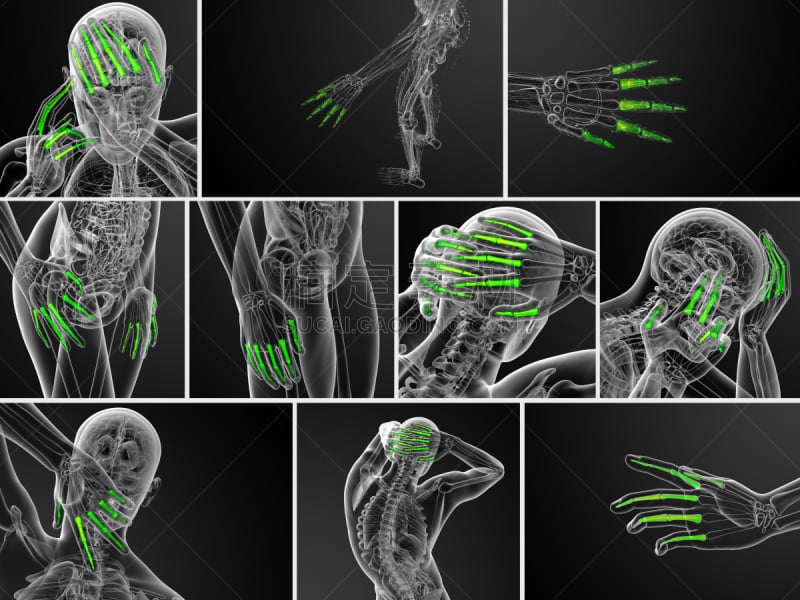 趾骨,三维图形,手,人,绘画插图,骨关节炎,肌腱,风湿病,骨质疏松症,人类骨架