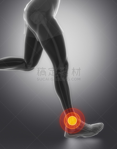 踝,关节,焦点,运动,条形码阅读机,慢跑,胫骨,腓骨,女人,阿基里斯