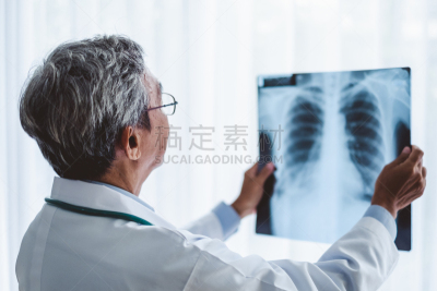 x光,健康保健,病人,男人,影片,概念,水平画幅,古老的,人类肺脏