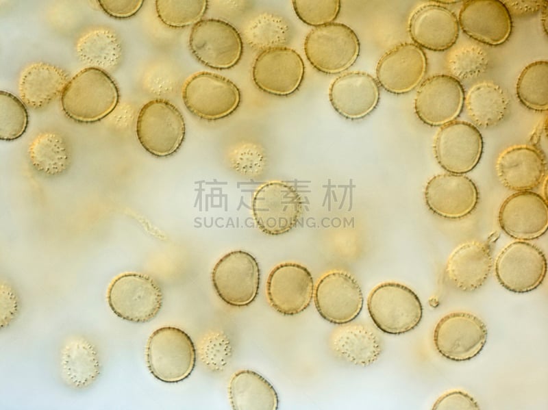 孢子,黏菌,放大效果,微球菌,原形体,阿米巴,单细胞生物,原生动物,大规模的放大,真菌和霉菌