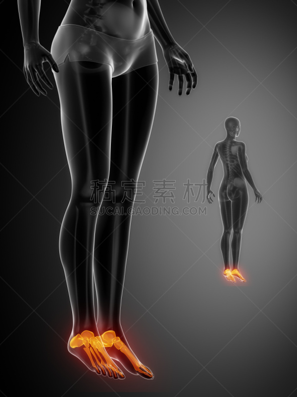 踝,打叉,黑色,γ射线扫描,垂直画幅,身体受伤,女人,韧带,腓骨