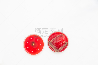 细菌,皮氏培养皿,生物科技,水平画幅,装管,无人,试管,玻璃,科学实验,科学